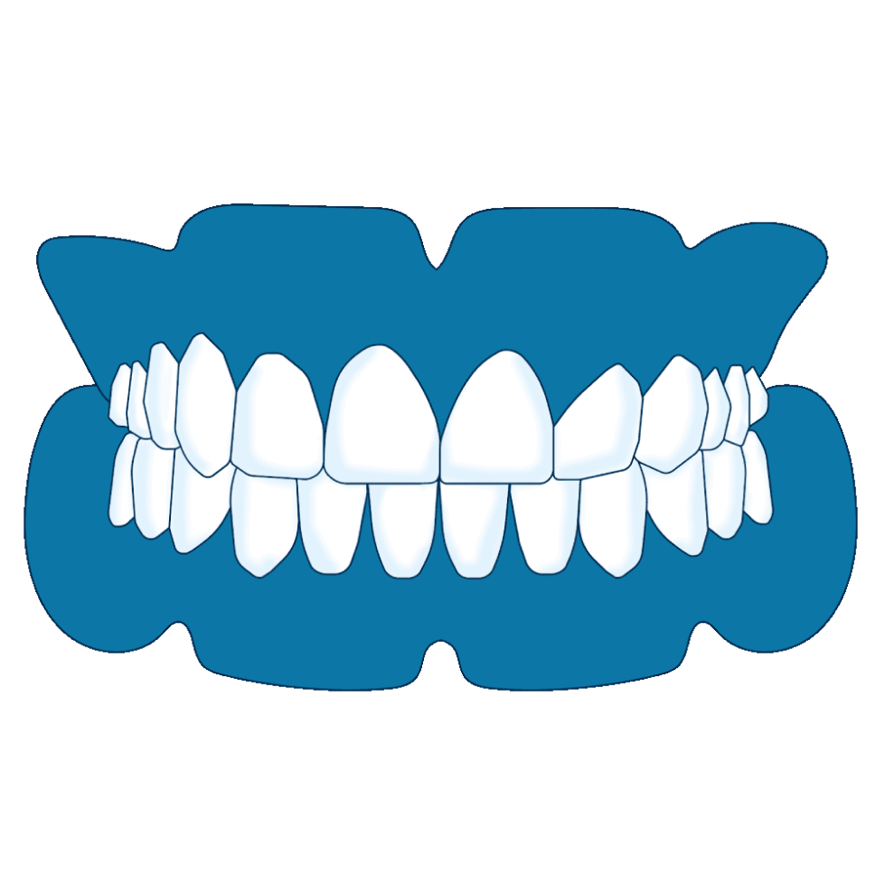 Full dentures