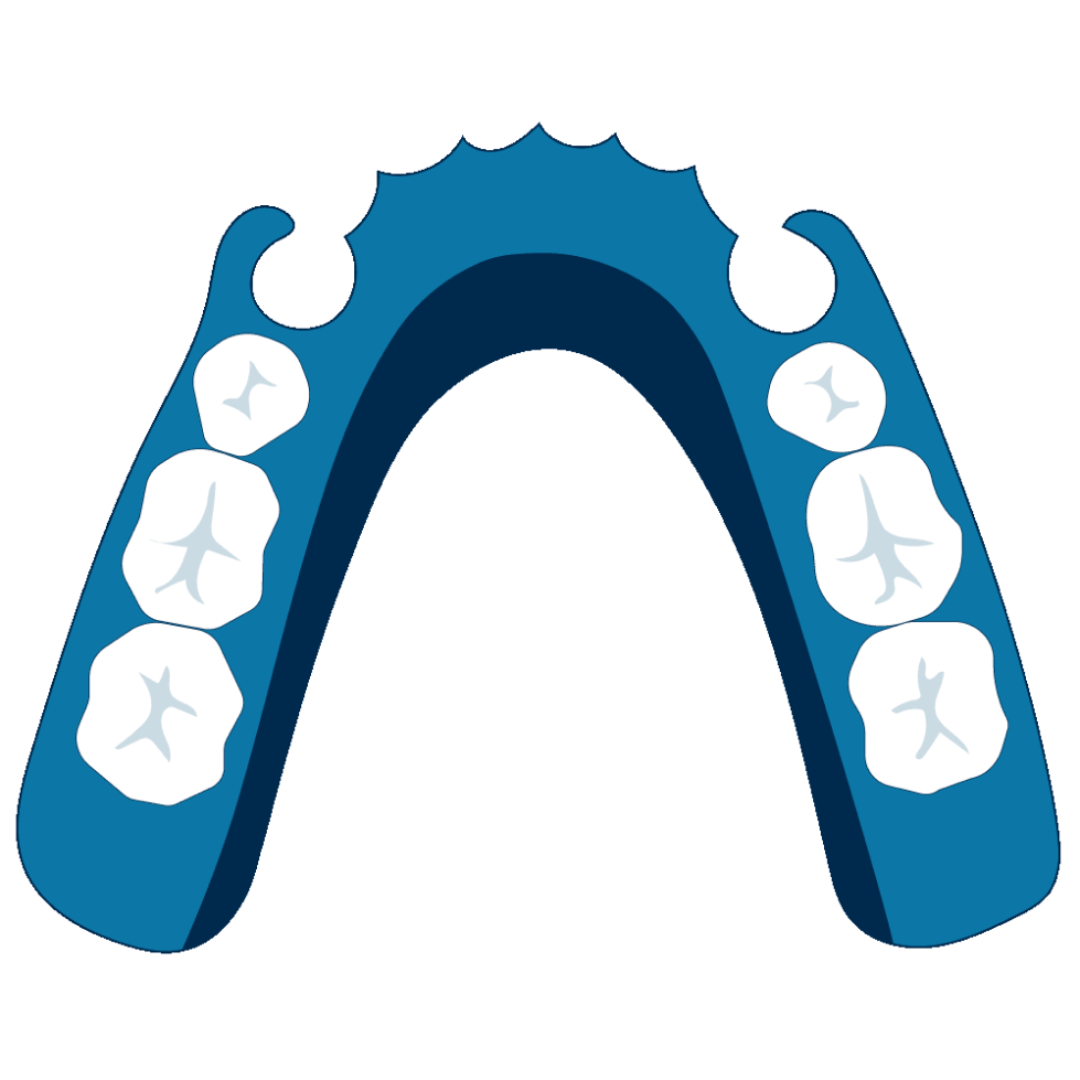 Partial dentures for back teeth